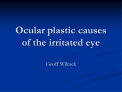 Ocular plastic causes of the irritated eye