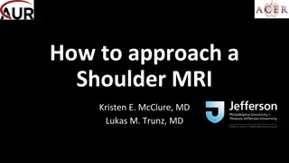 1. **Comprehensive Shoulder MRI Evaluation Protocol**
   
2. **In this detailed MRI protocol for the shoulder, various s
