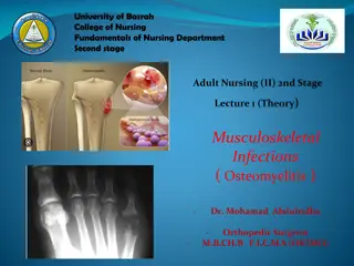 Musculoskeletal Infections (Osteomyelitis): Classification, Pathophysiology, and Clinical Manifestations