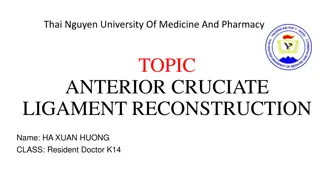 Anterior Cruciate Ligament Reconstruction: Overview and Diagnosis