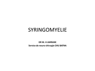 Understanding Syringomyelia: Causes, Symptoms, and Treatment Options