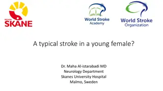 Risk Factors, Etiology, and Management of Stroke in Young and Older Women