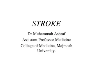 Understanding Stroke: Types, Mechanism, and Risk Factors