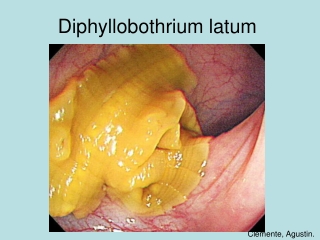 ilide.info-diphyllobothrium-latum-pr_4870ca271399ae8fcdd8ad166cc9da01