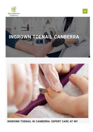 Foot Doctor Canberra