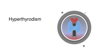 Hyperthyroidism