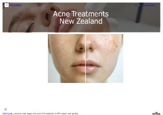 Acne Treatments New Zealand
