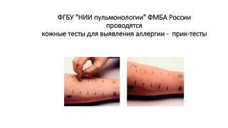 Прик-тесты