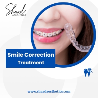 Shaad Aesthetics Smile Correction treatment