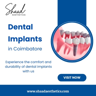 Dental Implants cost in Coimbatore
