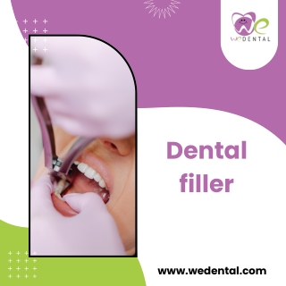 Dental fillers
