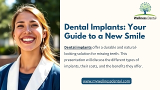 Dental Implants: Your Guide to a New Smile