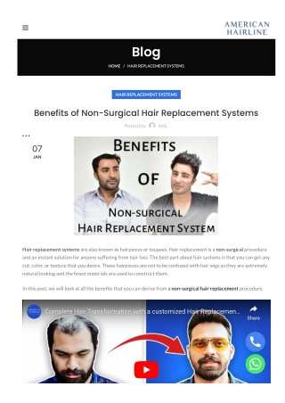 Benefits of Non-Surgical Hair Replacement Systems