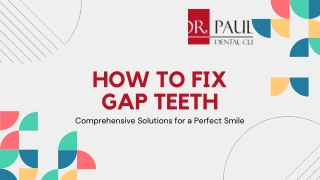 How to Fix Gap Teeth: Treatment Costs and Options