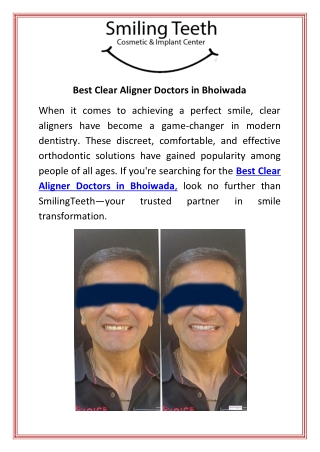 Best Clear Aligner Doctors in Bhoiwada