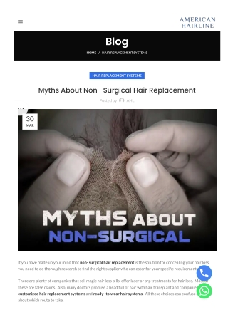 Myths About Non- Surgical Hair Replacement