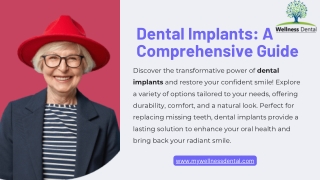 Dental Implants: A Comprehensive Guide