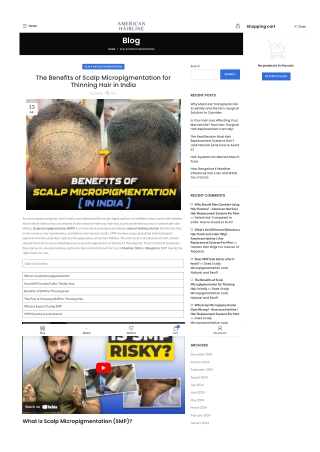 The Benefits of Scalp Micropigmentation for Thinning Hair in India