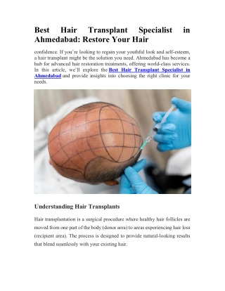 Best Hair Transplant Specialist in Ahmedabad