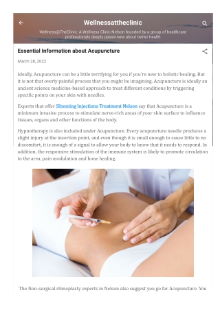 wellnessattheclinic-blogspot-com-2022-03-essential-information-about-acupuncture...