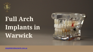 Full Arch Implants in Warwick