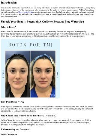 Unlock Your Beauty Potential: A Guide to Botox at Blue Water Spa