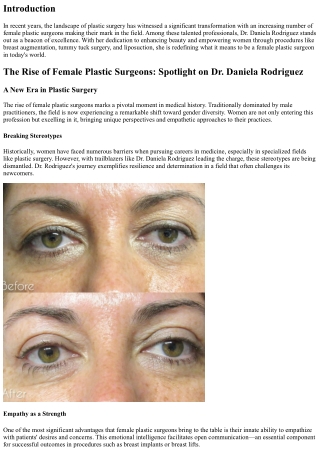 The Rise of Female Plastic Surgeons: Spotlight on Dr. Daniela Rodriguez