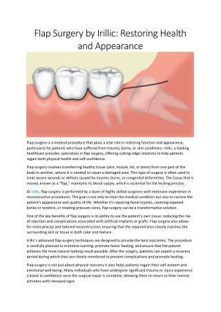 Flap Surgery by Irillic: Restoring Health and Confidence
