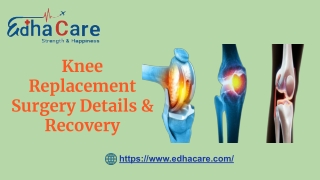 Knee Replacement Surgery Details & Recovery