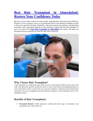 Best Hair Transplant in Ahmedabad