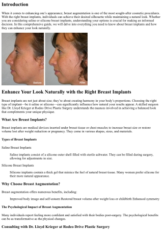 Enhance Your Look Naturally with the Right Breast Implants