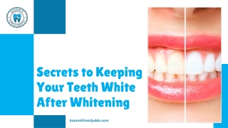 Tips to Keep Your Teeth White After Whitening