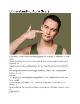 Best dermatology clinics in Bangalore for acne scars