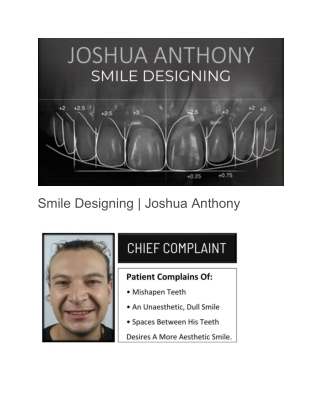 Top smile design dentist Nagercoil