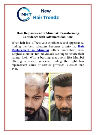 Hair Replacement in Mumbai Transforming Confidence with Advanced Solutions
