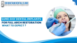 Same-Day Dental Implants for Full Arch Restoration: What to Expect?