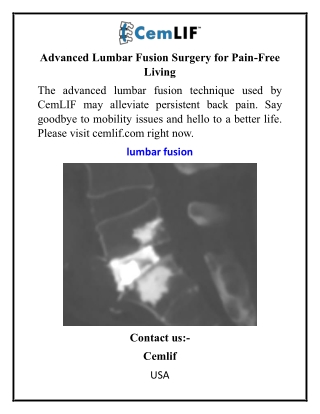 Advanced Lumbar Fusion Surgery for Pain-Free Living