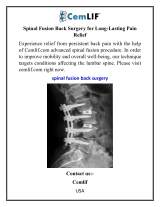Spinal Fusion Back Surgery for Long-Lasting Pain Relief