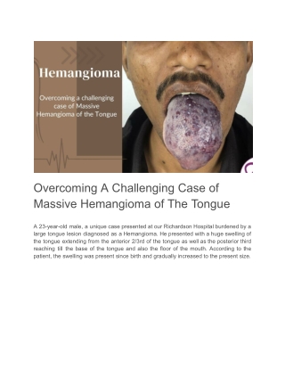 Tongue Tumor Treatment Nagercoil