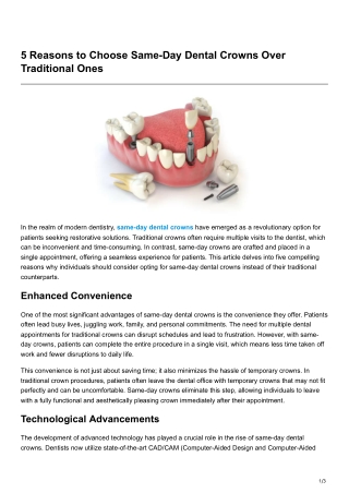 5 Reasons to ChooseSame-Day Dental CrownsOver Traditional Ones