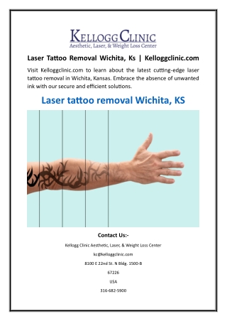 Laser Tattoo Removal Wichita, Ks  Kelloggclinic.com