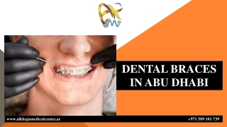 DENTAL BRACES  IN ABU DHABI