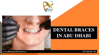 DENTAL BRACES  IN ABU DHABI
