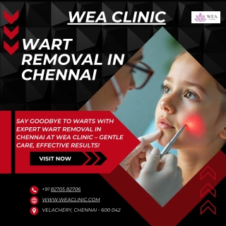Effective Wart Removal in Chennai at WEA Clinic
