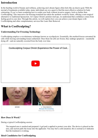 Achieve Your Dream Figure with CoolSculpting at Corpus Christi's Premier Med Spa