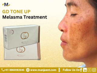 GD TONE UP Melasma Treatment