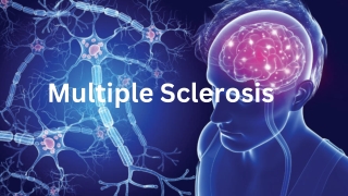 Multiple Sclerosis