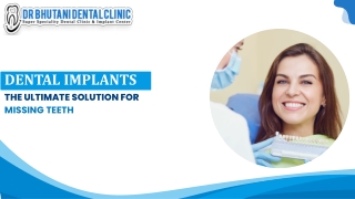 Dental Implants: The Ultimate Solution for Missing Teeth