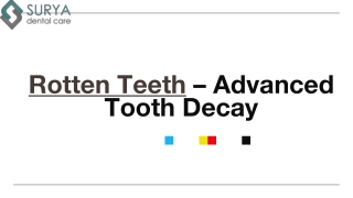 Rotten Teeth - Causes and Treatments