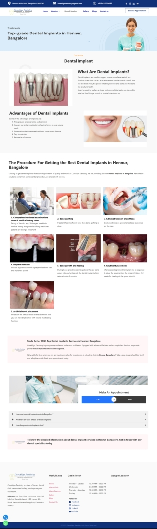 Dental-Implants-in-Hennur-Bangalore-CureAlign-Dentistry